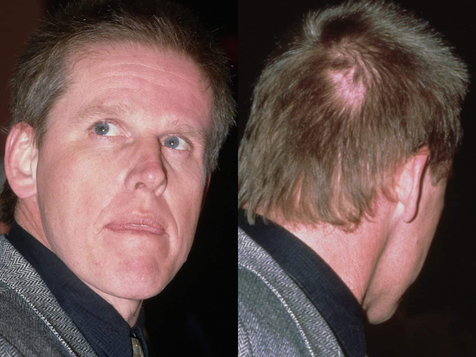 Gary Busey Motorcycle Accident Turned His Personality Up To 11